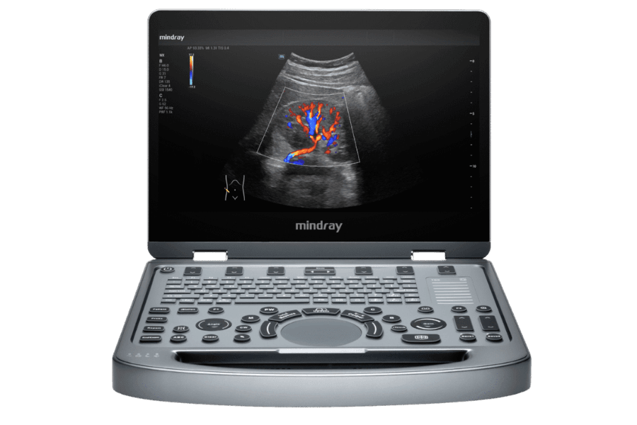 Mindray Mx3 foto 2