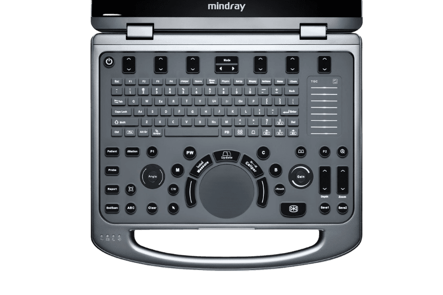 Mindray Mx3 foto 3